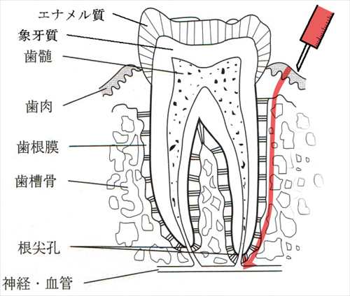 歯医者の麻酔 千葉ニュータウンの歯科 歯医者