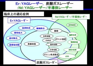 レーザー用と_R